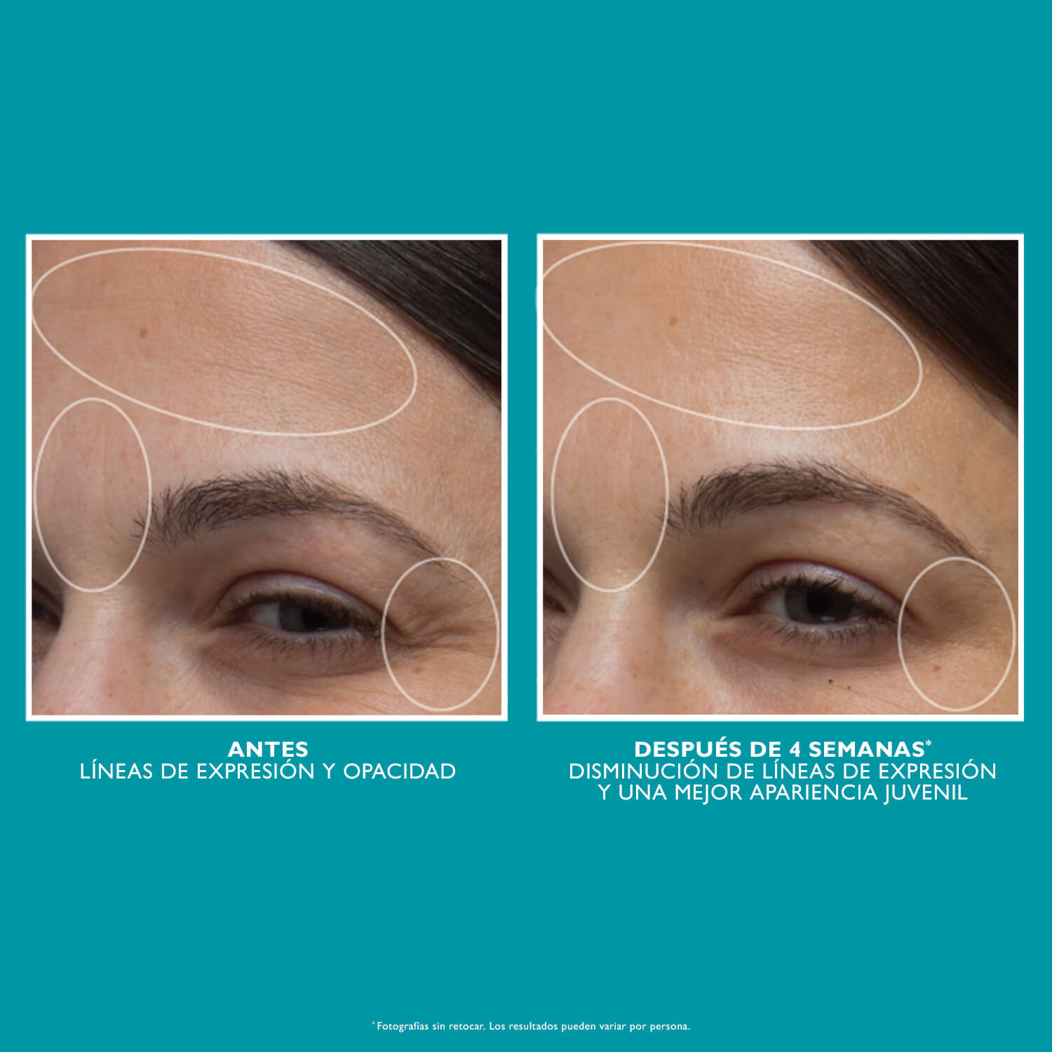PEPTIDE SKINJECTION™ MOISTURE INFUSION REFILLABLE CREAM (CREMA HIDRATANTE)